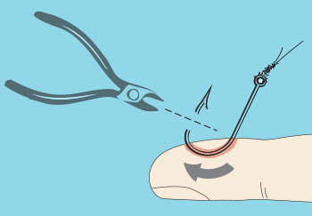How To Remove A Fish Hook